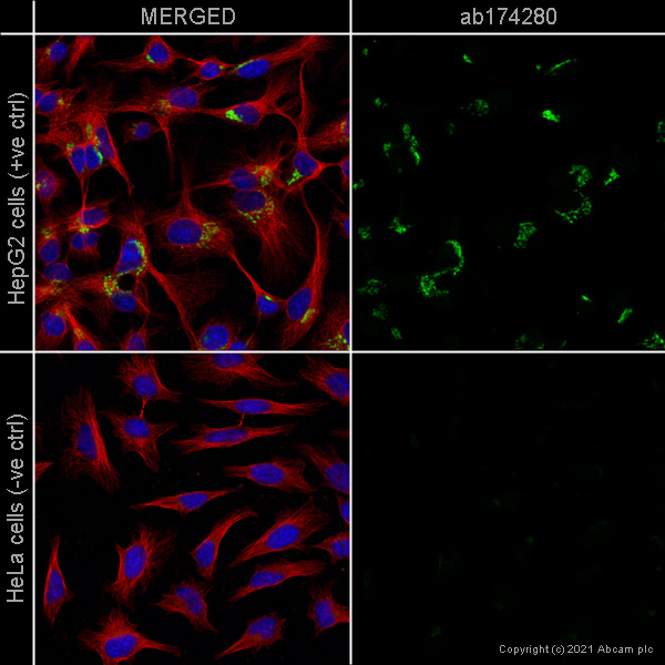 Immunocytochemistry/ Immunofluorescence - Anti-TGN46 antibody [EPR12676] (ab174280), expandable thumbnail