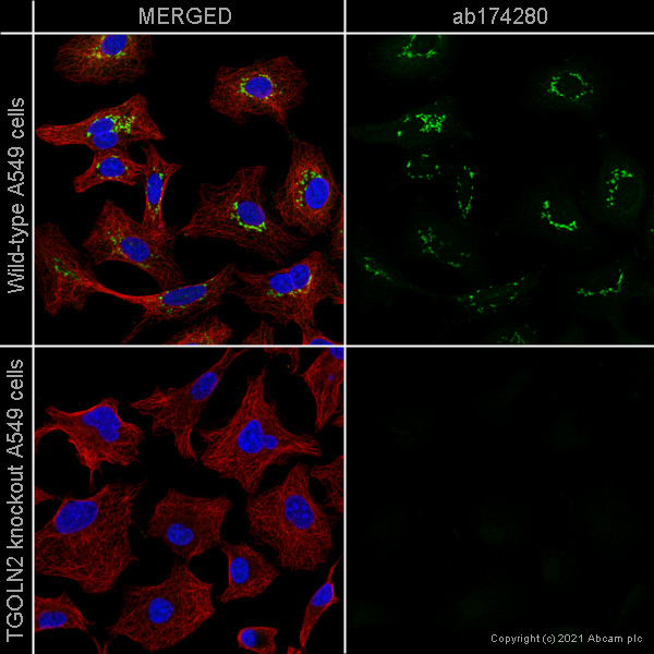 Immunocytochemistry/ Immunofluorescence - Anti-TGN46 antibody [EPR12676] (AB174280), expandable thumbnail