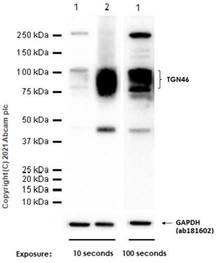 Western blot - Anti-TGN46 antibody [EPR12676] - Golgi Marker (AB174280), expandable thumbnail