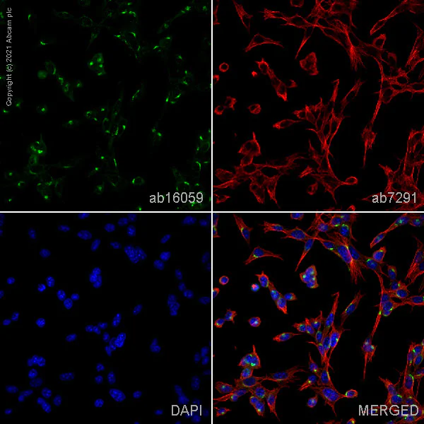 Immunocytochemistry - Anti-TGN46 antibody - Golgi Marker (AB16059)