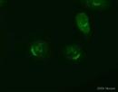 Immunocytochemistry - Anti-TGN46 antibody - Golgi Marker (AB16059), expandable thumbnail