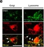 Immunocytochemistry/ Immunofluorescence - Anti-TGN46 antibody - Golgi Marker (AB16059)