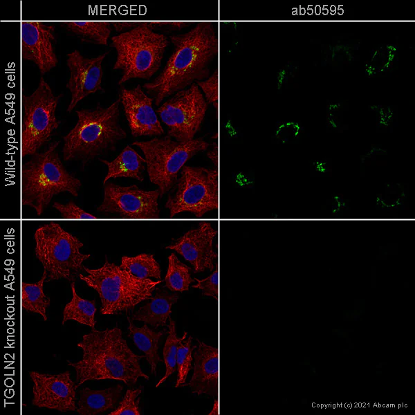 Immunocytochemistry - Anti-TGN46 antibody - Golgi Marker (AB50595)