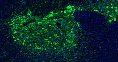 Immunohistochemistry (Formalin/PFA-fixed paraffin-embedded sections) - Anti-TH antibody [LNC1] - Chicken IgY (Chimeric) (AB325658)