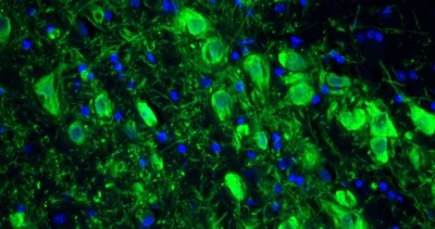 Immunohistochemistry (Formalin/PFA-fixed paraffin-embedded sections) - Anti-TH antibody [LNC1] - Chicken IgY (Chimeric) (AB325658)
