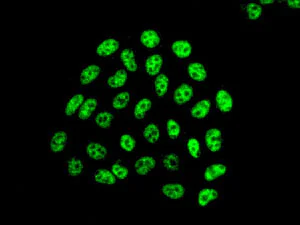 Immunocytochemistry/ Immunofluorescence - Anti-TH1L antibody [EPR11594] (AB170934)
