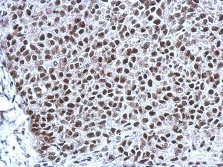 Immunohistochemistry (Formalin/PFA-fixed paraffin-embedded sections) - Anti-THAP11 antibody (AB154942), expandable thumbnail
