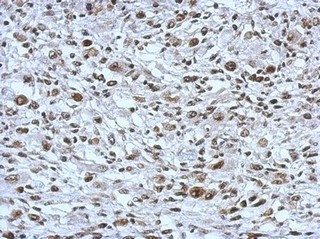 Immunohistochemistry (Formalin/PFA-fixed paraffin-embedded sections) - Anti-THAP11 antibody (AB154942), expandable thumbnail