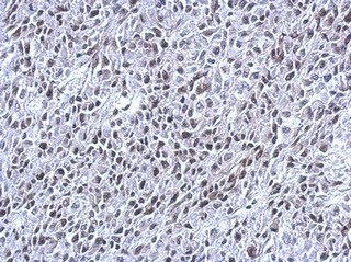 Immunohistochemistry (Formalin/PFA-fixed paraffin-embedded sections) - Anti-THAP11 antibody (AB154942), expandable thumbnail