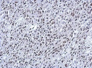 Immunohistochemistry (Formalin/PFA-fixed paraffin-embedded sections) - Anti-THAP11 antibody (AB154942)
