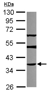 Western blot - Anti-THAP11 antibody (AB154942), expandable thumbnail