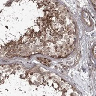 Immunohistochemistry (Formalin/PFA-fixed paraffin-embedded sections) - Anti-THAP9 antibody (AB122386)