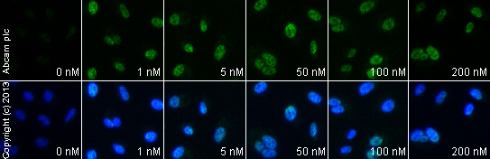 Functional Studies - Thapsigargin, Ca2+-ATPase inhibitor (AB120286), expandable thumbnail