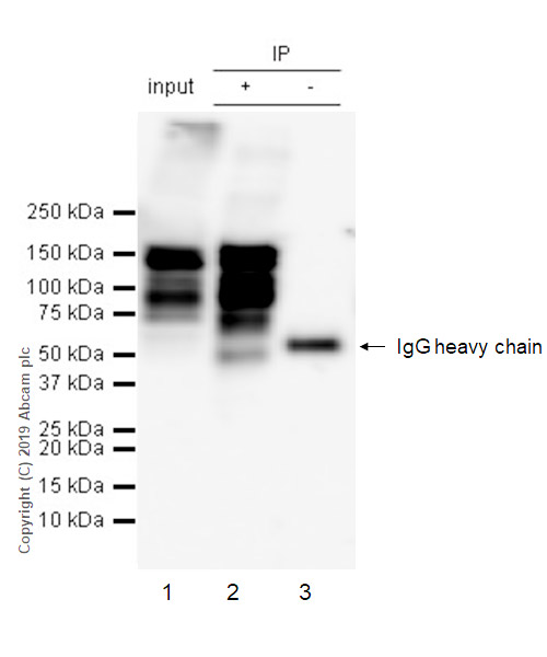Immunoprecipitation - Anti-THBS4 antibody [EPR22922-232] (AB263898)