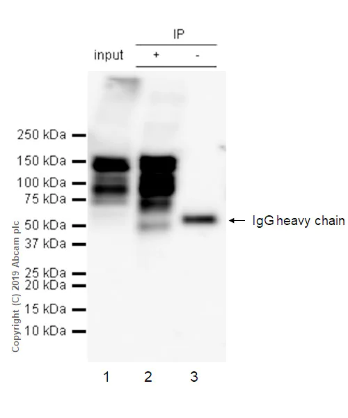 Immunoprecipitation - Anti-THBS4 antibody [EPR22922-232] (AB263898)