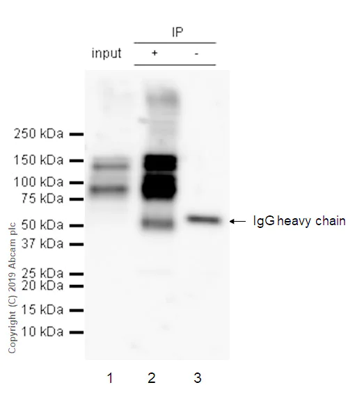 Immunoprecipitation - Anti-THBS4 antibody [EPR22922-232] (AB263898)