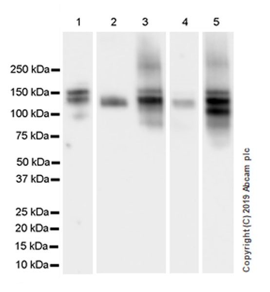 Western blot - Anti-THBS4 antibody [EPR22922-232] (AB263898)