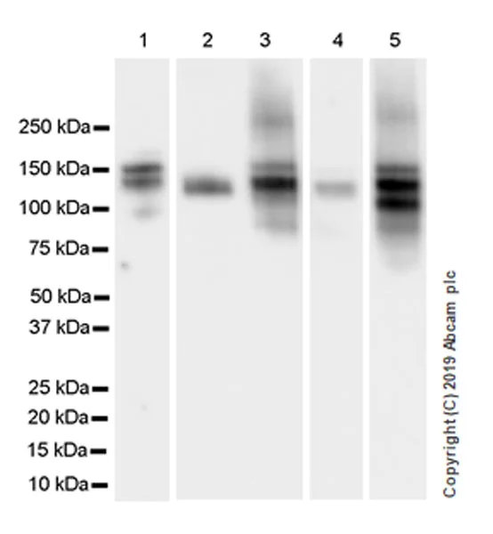 Western blot - Anti-THBS4 antibody [EPR22922-232] (AB263898)