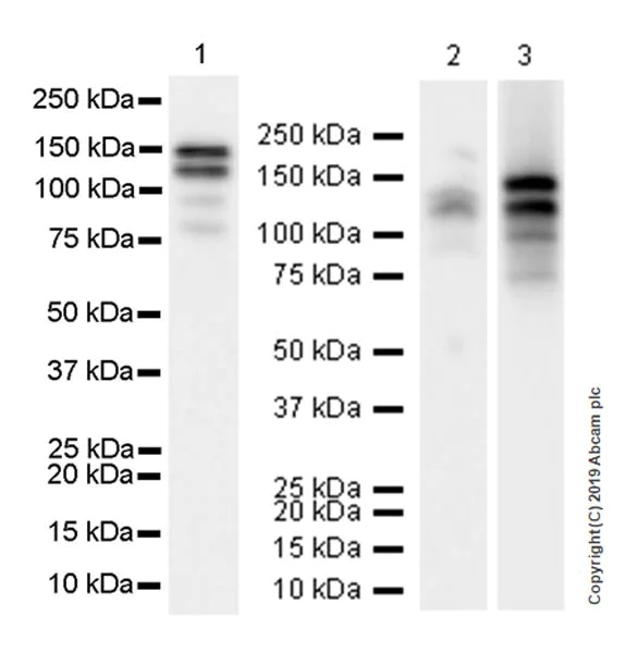 Western blot - Anti-THBS4 antibody [EPR22922-232] (AB263898)