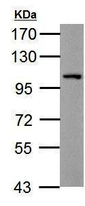 Western blot - Anti-THBS4 antibody - N-terminal (AB211143), expandable thumbnail