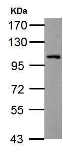 Western blot - Anti-THBS4 antibody - N-terminal (AB211143)