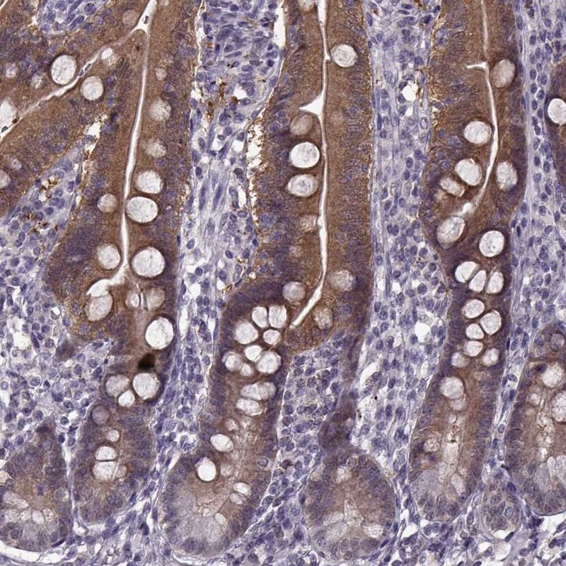 Immunohistochemistry (Formalin/PFA-fixed paraffin-embedded sections) - Anti-THEA antibody (AB253013), expandable thumbnail