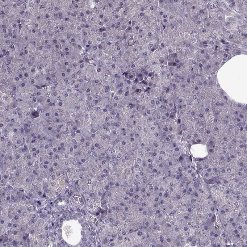 Immunohistochemistry (Formalin/PFA-fixed paraffin-embedded sections) - Anti-THEA antibody (AB253013), expandable thumbnail