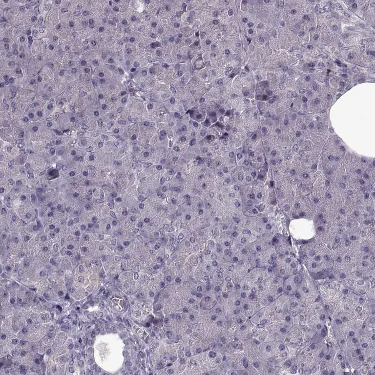 Immunohistochemistry (Formalin/PFA-fixed paraffin-embedded sections) - Anti-THEA antibody (AB253013)