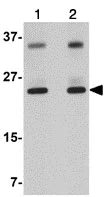 Western blot - Anti-THEM4 antibody (AB106435)