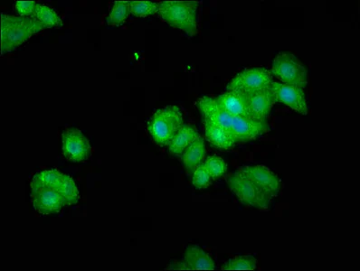 Immunocytochemistry/ Immunofluorescence - Anti-Themis antibody (AB237626)