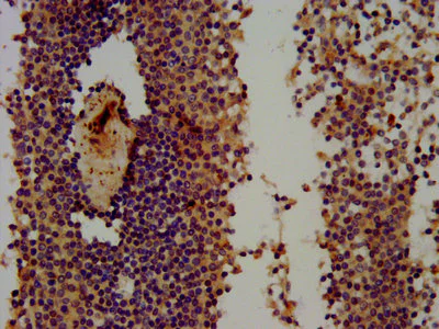 Immunohistochemistry (Formalin/PFA-fixed paraffin-embedded sections) - Anti-Themis antibody (AB237626)
