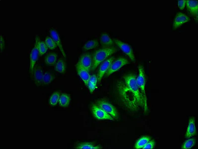 Immunocytochemistry/ Immunofluorescence - Anti-THIK-1 antibody (AB237624)