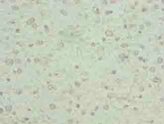 Immunohistochemistry (Formalin/PFA-fixed paraffin-embedded sections) - Anti-THIK-1 antibody (AB237624)