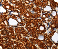 Immunohistochemistry (Formalin/PFA-fixed paraffin-embedded sections) - Anti-Thioredoxin / TRX antibody (AB185329)