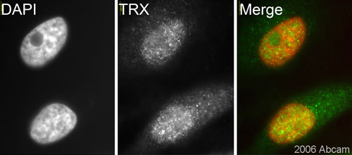 Immunocytochemistry/ Immunofluorescence - Anti-Thioredoxin / TRX antibody (AB26320), expandable thumbnail