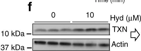 Western blot - Anti-Thioredoxin / TRX antibody (AB26320)