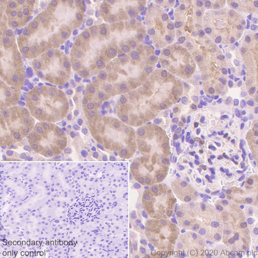Immunohistochemistry (Formalin/PFA-fixed paraffin-embedded sections) - Anti-Thioredoxin / TRX antibody [EPR23843-48] (AB273877), expandable thumbnail