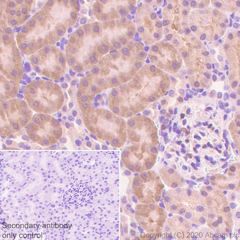 Immunohistochemistry (Formalin/PFA-fixed paraffin-embedded sections) - Anti-Thioredoxin / TRX antibody [EPR23843-48] (AB273877)