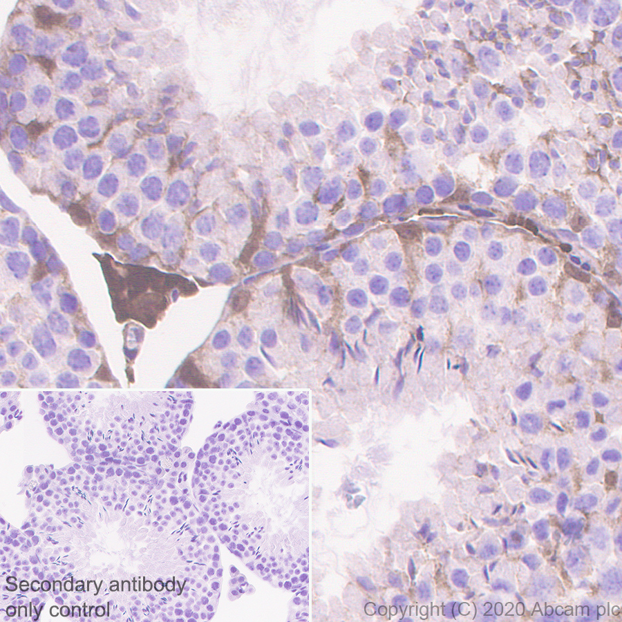 Immunohistochemistry (Formalin/PFA-fixed paraffin-embedded sections) - Anti-Thioredoxin / TRX antibody [EPR23843-48] (ab273877), expandable thumbnail