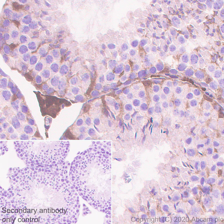 Immunohistochemistry (Formalin/PFA-fixed paraffin-embedded sections) - Anti-Thioredoxin / TRX antibody [EPR23843-48] (AB273877)