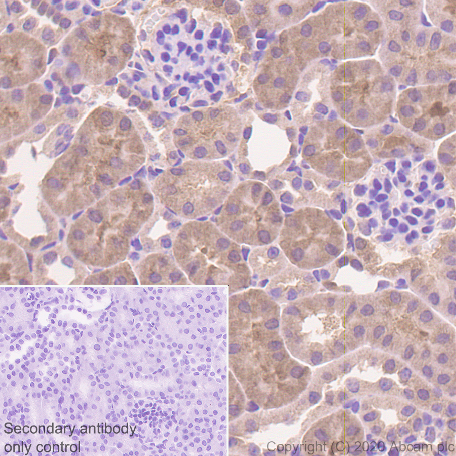 Immunohistochemistry (Formalin/PFA-fixed paraffin-embedded sections) - Anti-Thioredoxin / TRX antibody [EPR23843-48] (AB273877), expandable thumbnail