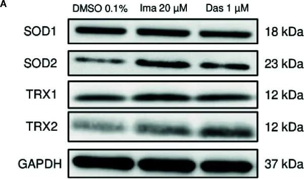 Western blot - Anti-Thioredoxin / TRX antibody [EPR6111] (AB109385)