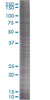 Thioredoxin / TRX overexpression 293T lysate (whole cell)