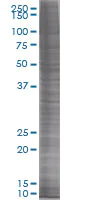 SDS-PAGE - Thioredoxin / TRX overexpression 293T lysate (whole cell) (AB94039)