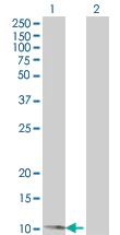 Western blot - Thioredoxin / TRX overexpression 293T lysate (whole cell) (AB94039)