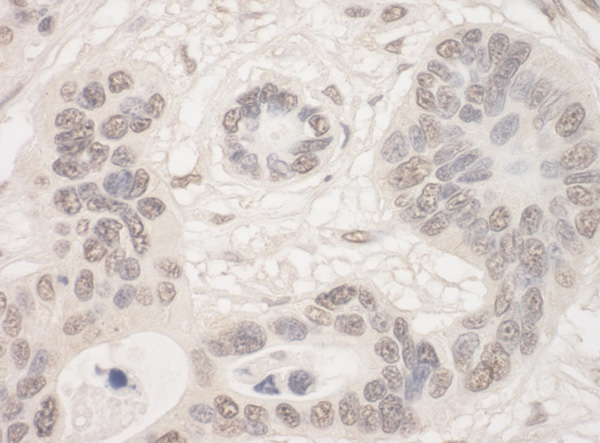 Immunohistochemistry (Formalin/PFA-fixed paraffin-embedded sections) - Anti-THOC2/Tho2 antibody (AB129485), expandable thumbnail