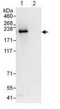 Immunoprecipitation - Anti-THOC2/Tho2 antibody (AB129485), expandable thumbnail