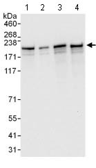 Western blot - Anti-THOC2/Tho2 antibody (AB129485), expandable thumbnail