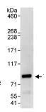 Immunoprecipitation - Anti-THOC5 antibody (AB86070)