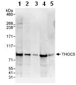 Western blot - Anti-THOC5 antibody (AB86070)